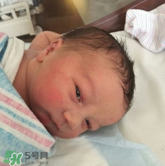 新生兒手握避孕環(huán)出生是怎么回事？出生后健康嗎？