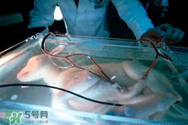 人造子宮能生孩子嗎？人造子宮成功案例