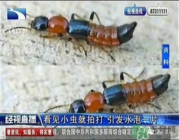 隱翅蟲(chóng)有毒嗎？隱翅蟲(chóng)會(huì)毀容嗎？