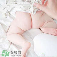 尿布疹和濕疹的區(qū)別 尿布疹和濕疹如何區(qū)分？
