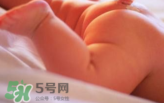 寶寶尿布疹可以擦紅霉素軟膏嗎？紅霉素軟膏對(duì)尿布疹有效嗎？