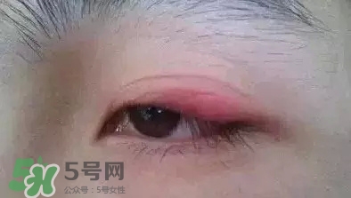 長期用假睫毛雙眼皮貼對眼睛有什么傷害？