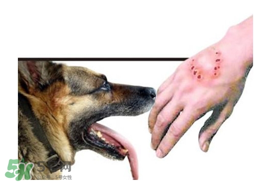 狂犬病會傳染嗎？狂犬病會學(xué)狗叫嗎
