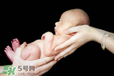 寶寶臍帶掉了要緊嗎？寶寶臍帶掉了出血了怎么辦？