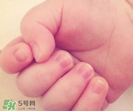 寶寶指甲凹凸不平是什么原因？寶寶指甲凹凸不平正常嗎？