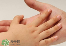 寶寶指甲凹凸不平是什么原因？寶寶指甲凹凸不平正常嗎？