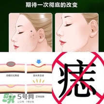 藥水點(diǎn)痣和激光點(diǎn)痣哪個(gè)好？各有什么優(yōu)缺點(diǎn)
