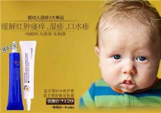 恩姆花園濕疹膏有激素嗎？恩姆花園濕疹膏含不含激素？