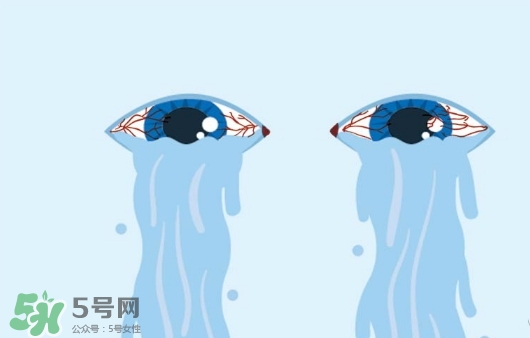 眼藥水可以兩個(gè)人用嗎？眼藥水可以共用嗎？