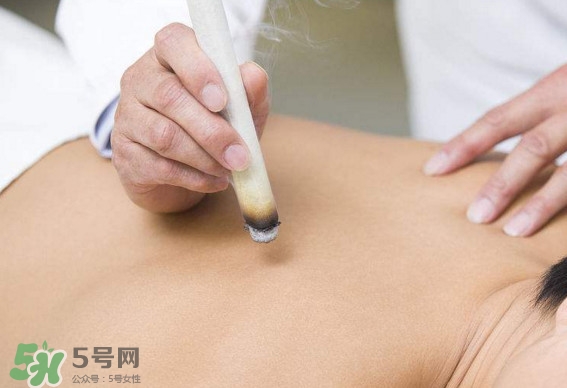 一天中什么時間艾灸好？艾灸什么時間做最好