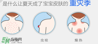 妙思樂爽膚水好用嗎？妙思樂爽膚水能去痱嗎？