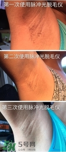松下es wh93脫毛儀怎么樣？松下es wh93脫毛儀多少錢