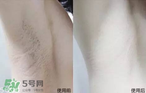 nair脫毛膏評(píng)測(cè)？nair脫毛膏保質(zhì)期
