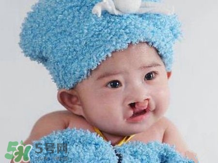兔唇可以治嗎？兔唇修補(bǔ)術(shù)