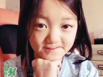 兔唇是什么？兔唇是什么原因造成的？
