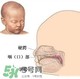兔唇能檢查出來嗎？兔唇能完全修復嗎？