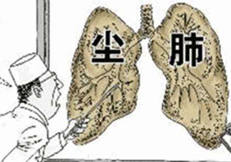 塵肺病能治愈嗎？塵肺病能活多久