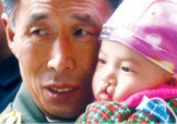 兔唇是什么？兔唇是什么原因造成的？