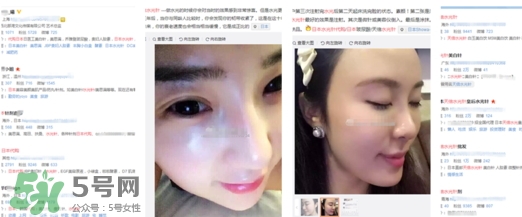 天倍面膜是日本的嗎？日本tenbe天倍面膜騙局