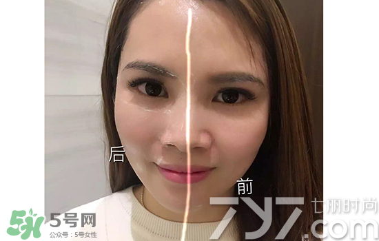 黃金棒有什么用？黃金棒的功效與作用