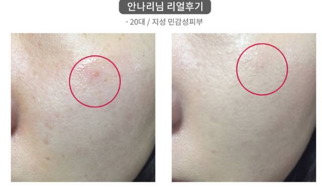 real skin patch怎么樣？real skin是什么牌子