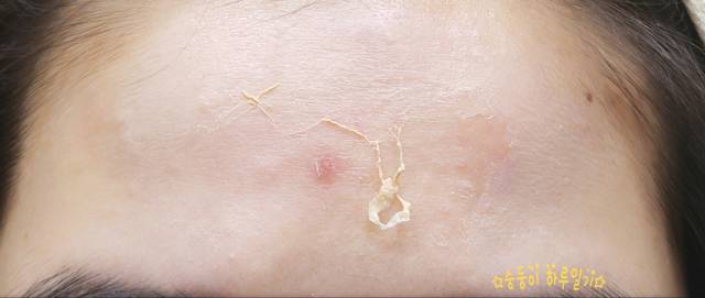 real skin patch怎么樣？real skin是什么牌子