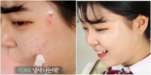 real skin patch怎么樣？real skin是什么牌子