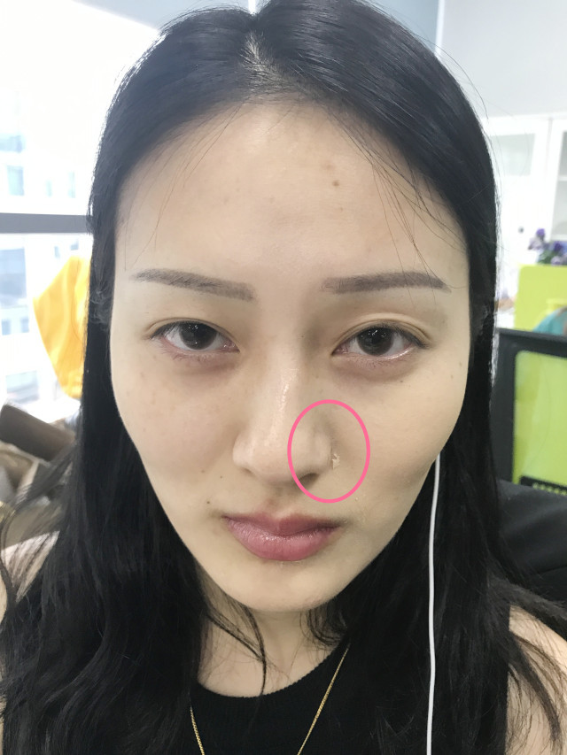 real skin patch怎么樣？real skin是什么牌子
