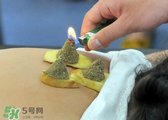 三伏灸灸哪里？三伏灸是每天都灸嗎