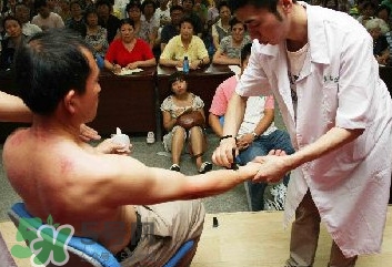 刮痧痛嗎？刮痧疼還是拔罐疼