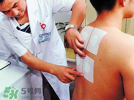 三伏灸可以治療什么病？三伏灸與艾灸有什么區(qū)別