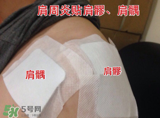 艾灸貼多少錢一盒?？艾灸貼一盒60裝多少錢？