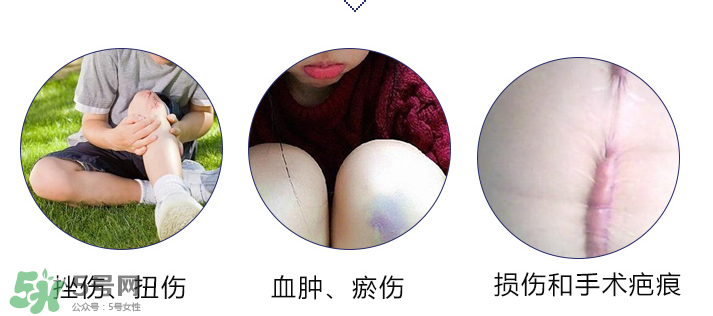 hirudoid除疤膏有效嗎？hirudoid去疤膏效果如何？
