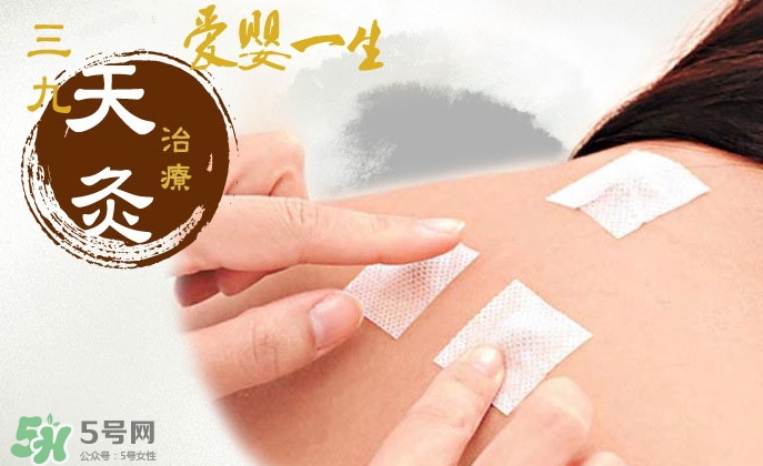 貼三伏貼掛什么科？三伏貼掛什么號？