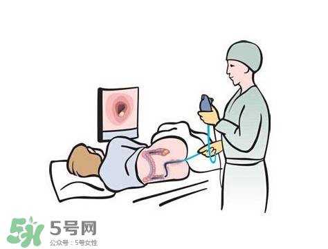 直腸癌怎么查出來的？直腸癌怎么判斷早晚期
