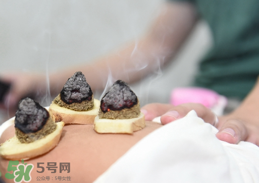 三伏灸什么人不能做？三伏灸適合哪些人？