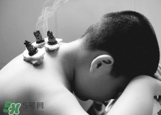 三伏灸什么人不能做？三伏灸適合哪些人？