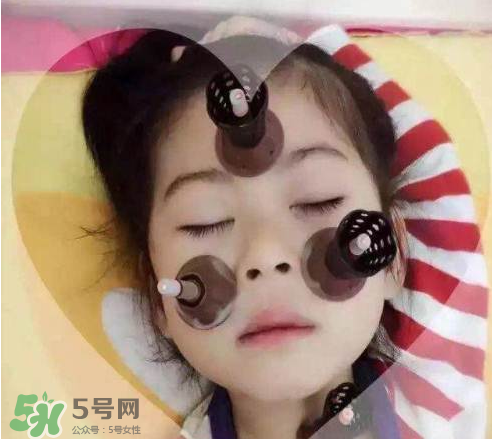 艾灸貼可以治咳嗽嗎？艾灸貼可以治退燒嗎？