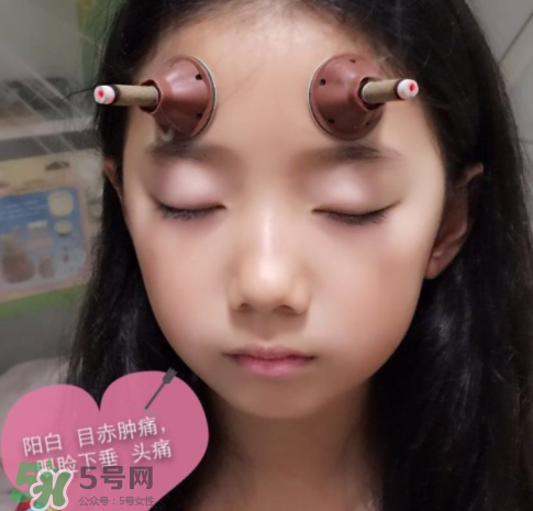 艾灸貼可以治咳嗽嗎？艾灸貼可以治退燒嗎？