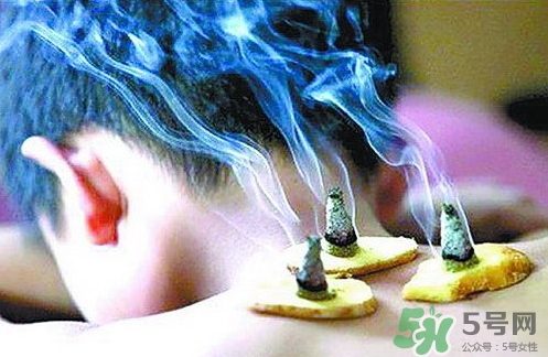 三伏灸什么時(shí)候開(kāi)始灸？三伏灸怎么灸？