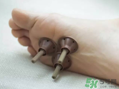 艾艾貼灸出水珠為什么？艾艾貼后有水珠要擦嗎？