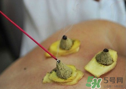 三伏灸可以自己灸嗎？三伏灸可以在家做嗎？