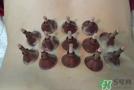 艾艾貼可以貼肚臍眼嗎？艾艾貼貼肚臍有什么作用？