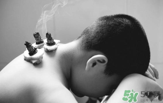 三伏灸要灸幾次？三伏灸要灸多久？