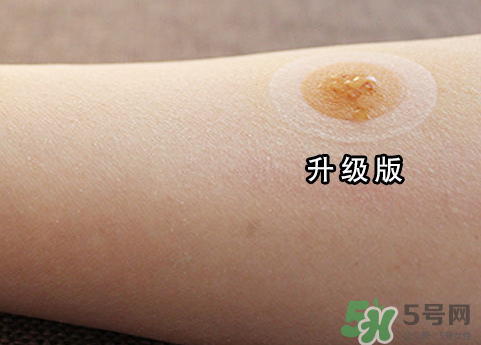 艾灸貼后有水泡怎么辦？貼艾灸貼應(yīng)注意些什么？