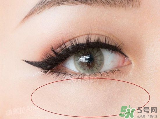 玻尿酸填充淚溝多久恢復(fù)自然？玻尿酸填充淚溝的危害
