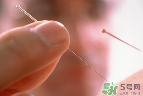 針灸可以治療失眠嗎？失眠時(shí)針灸哪些穴位有效