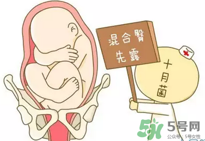 胎位不正能順產(chǎn)嗎？胎位不正怎么辦？