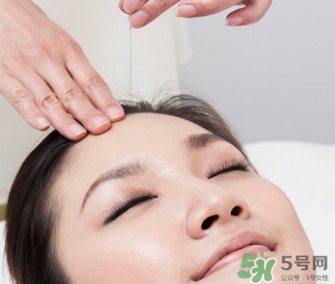 中醫(yī)院針灸一次多少錢？針灸后疼痛加重正常嗎