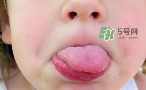 三伏天為什么濕氣重？三伏天為什么要注意祛濕？